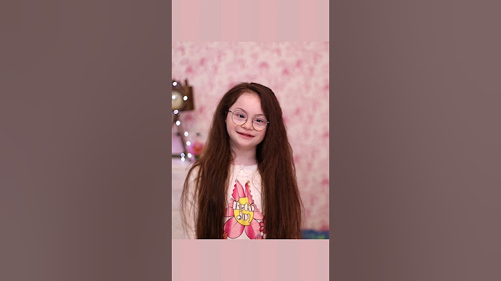 🌞АЗ СЪМ МИКАЕЛА и съм със СИНДРОМ НА ДАУН ❤️🌞 Чуйте моята история❤️