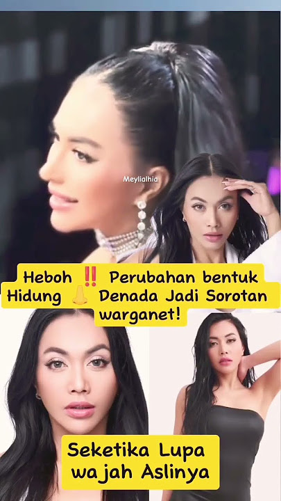Denada Bikin Syok! Hidung Baru Terlalu Mancung? Netizen Sampai Lupa Wajah Aslinya! #denada #trending