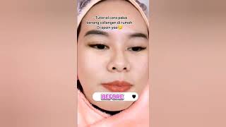 Serum D Tanam Benang Kolagen Tanpa Jarum Protein Line
