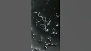 Thumbnail of dust in our nails in microscope view #shorts #microscope #nails #germs