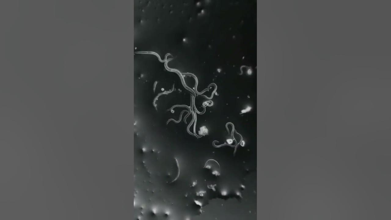 dust in our nails in microscope view #shorts #microscope #nails #germs