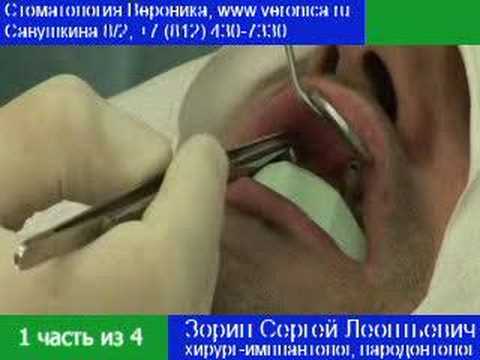 Имплантация зубов (Клиника Вероника) \ Часть 1