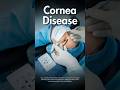 Cornea Problems Explained | Dr. Akash Deep #corneacare