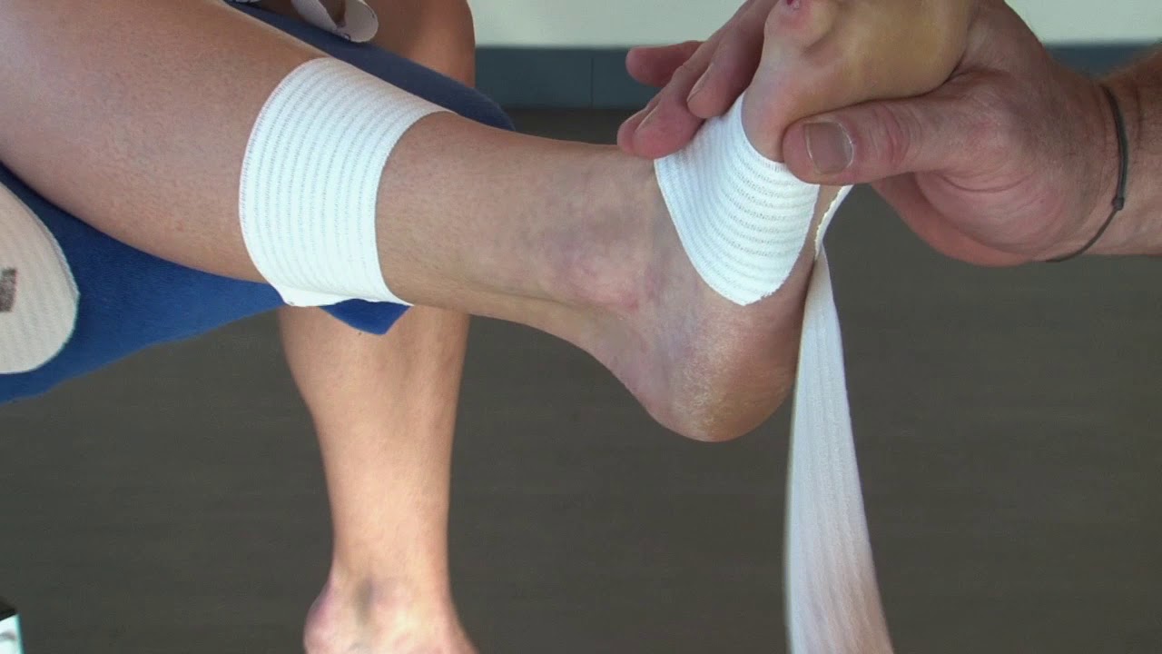 Contention adhésive de cheville en aigue