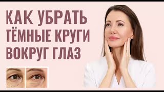 Как убрать темные круги вокруг глаз / убрать синяки под глазами