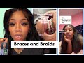 TikToker's Viral Illegal Braces Has Dentists Very Concerned (Part 2)