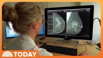 New AI Model Uses Mammograms to Predict Breast Cancer Risk