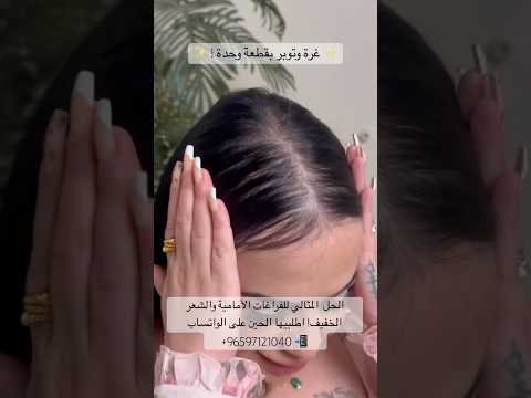 غرة توبر بقطعة وحدة الحل للشعر الخفيف والفراغات الأمامية طلبيها 96597121040 