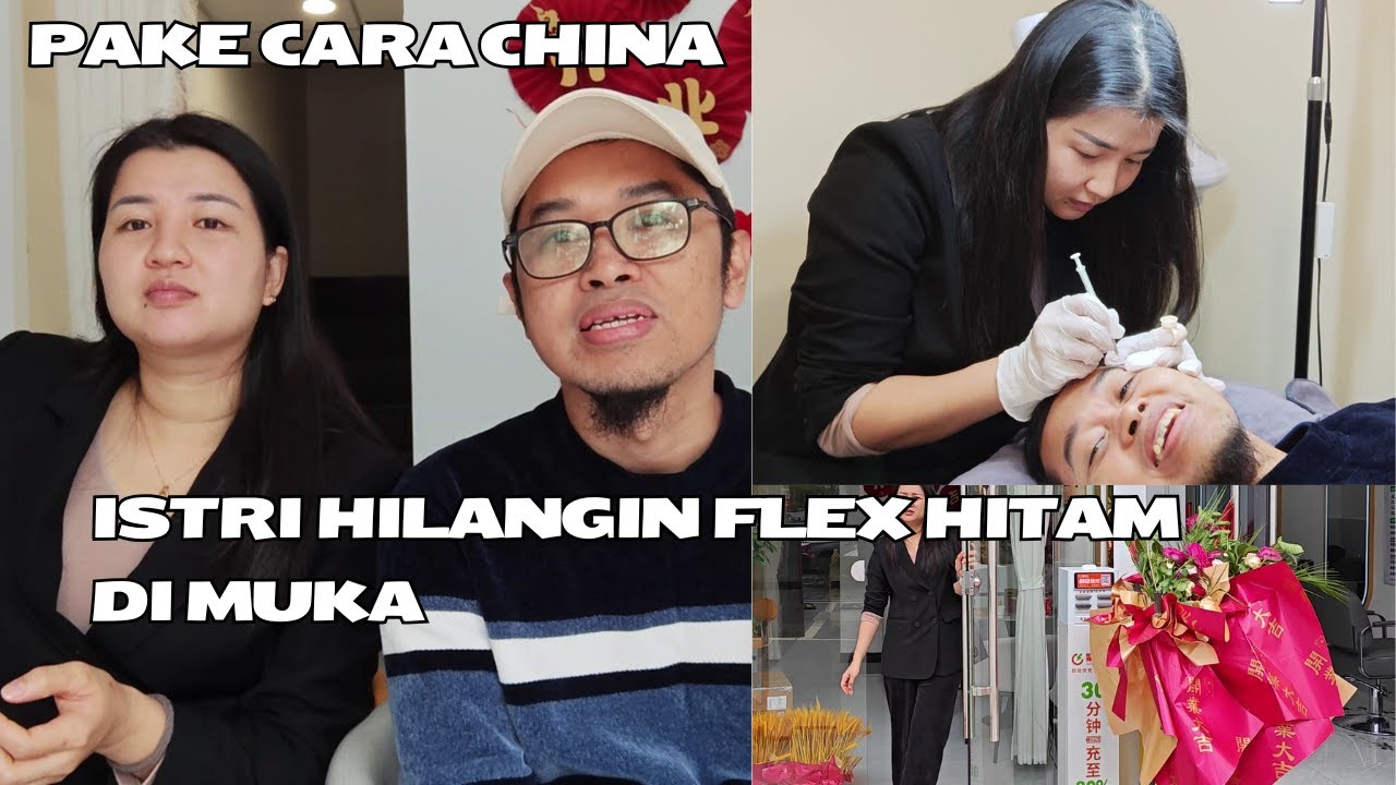 Mantab! ISTRI Bisa Hilangin Flex Hitam di Mukaku