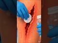 ⚠️ Not for the Weak Hearted! 😳Ek gehri leg injury... Aur phir doctors ne lagaye multiple stitches