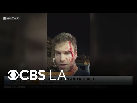 Actor Keegan Allen posted to Instagram after allegedly robbed at gunpoint in West Hollywood