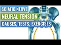 Eight Exercises to Relieve Sciatic Nerve Tension