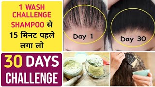 How to remove itching dandruff dry flaky scalp|use this remedy for fast hair growth & stop hair fall screenshot 1