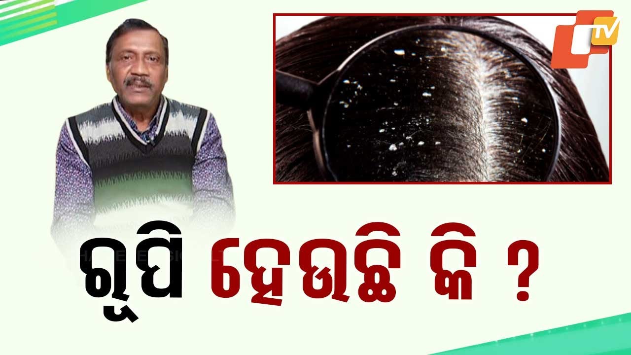 Stay Fit: Learn How to Free Yourself from Dandruff...