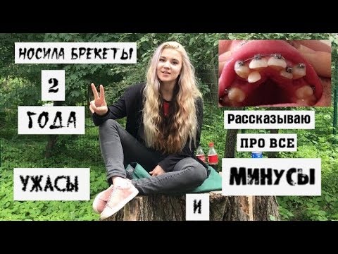 Вопрос: Как сохранять спокойствие перед тем, как поставить брекеты?