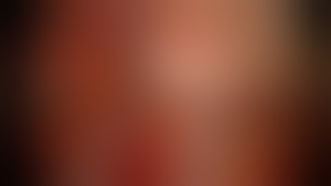 Right Upper Lobe Apical (S1) Segmentectomy Utilizing ICG Technology (Single port)