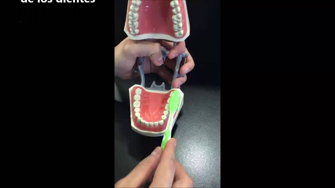 técnica de cepillado stillman modificado YouTube