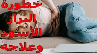 البراز الأسود | ماهى أسبابه ؟ | وماهى مخاطره على الصحة ؟ | معلومات هامه جداً