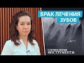 Удаление сломанных инструментов из канала зуба с помощью микроскопа