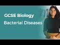 Bacterial Diseases | 9-1 GCSE Biology | OCR, AQA, Edexcel