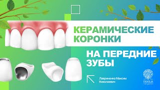 😁 Керамические коронки на передние зубы