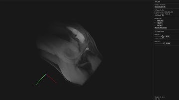 3D MRI Renderer (Rust/WASM)