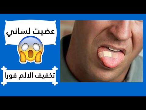 عضيت لساني انا وبتكلم 🥵 🥵 ! - علاج اللسان المجروح نتيجة العض اللا ارادي