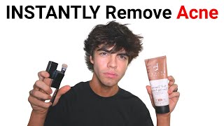 How to instantly get PERFECT skin as a guy