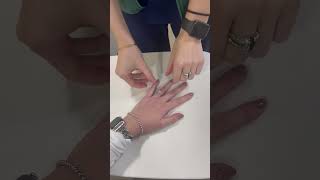 Famous Wartenberg's Sign Profile