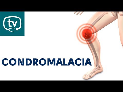 La condromalacia, una patología que afecta a la rodilla