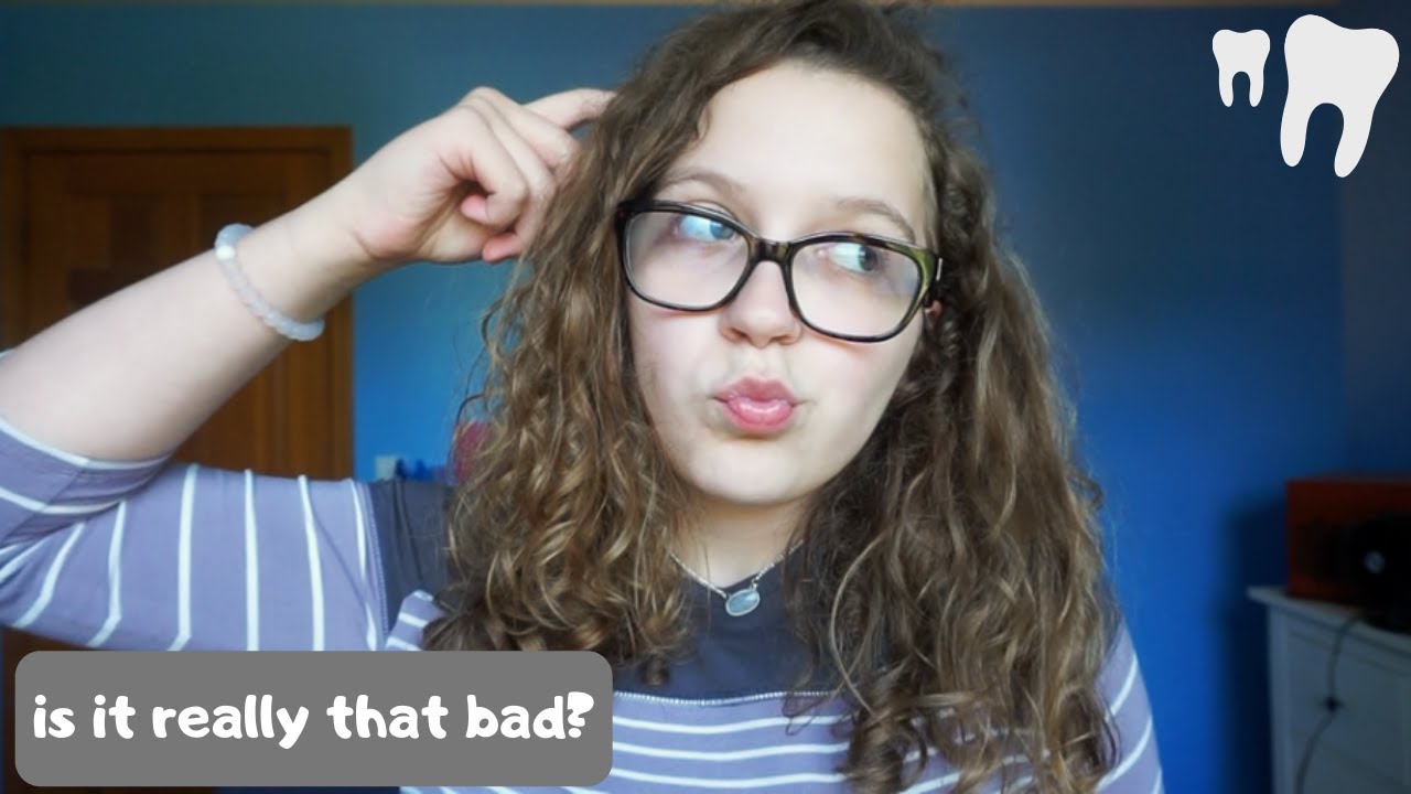 the reality of a canine exposure