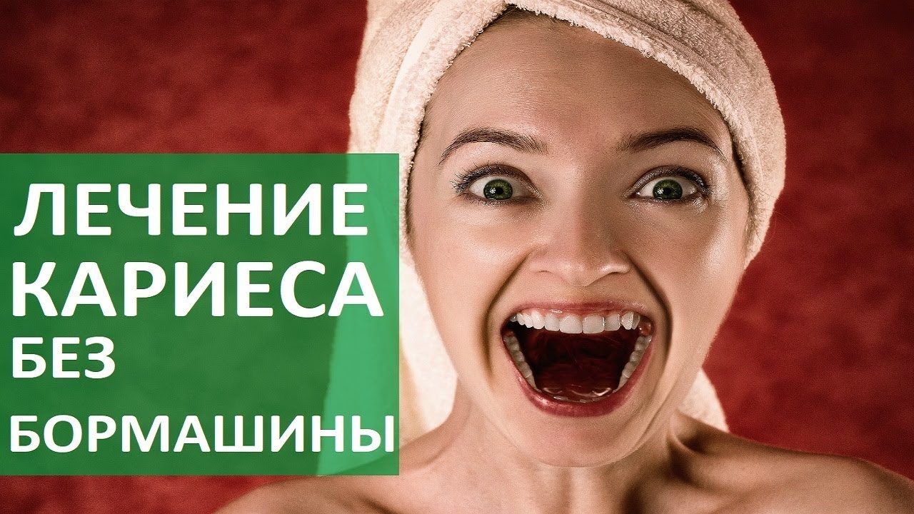 Лечение зубов без бормашины. 🤩 Современный метод лечения зубов без бормашины. Алена.