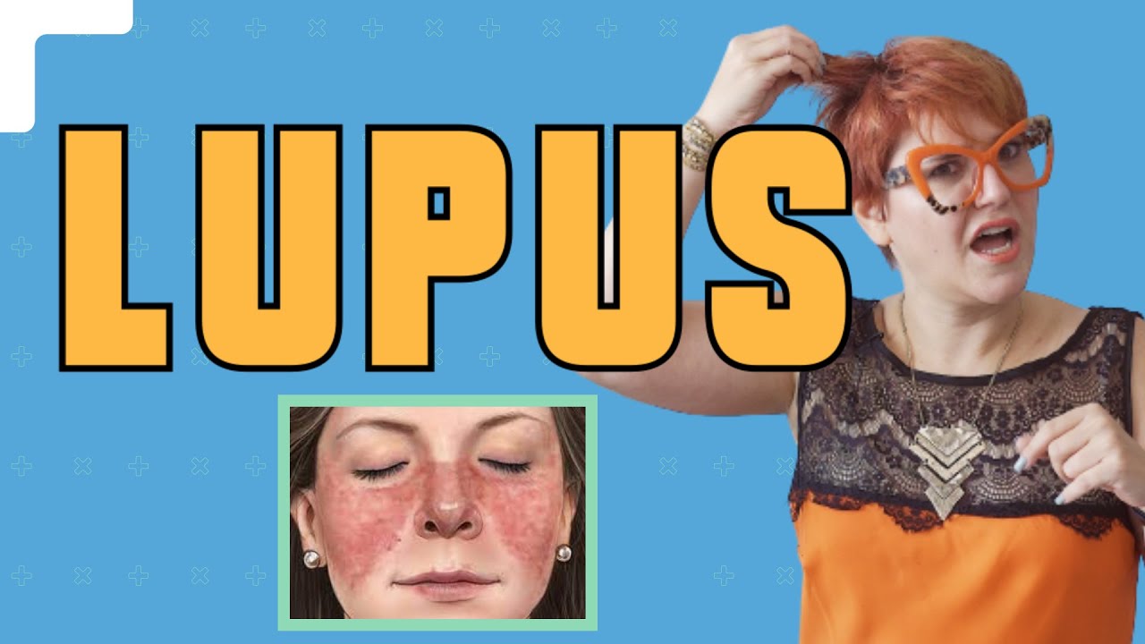 O QUE É O LUPUS E COMO TRATÁ-LO?