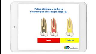 DEREC iOS iPad app - Add Endo AI - www.derec.ch screenshot 5