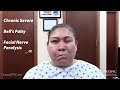 Chronic Severe Bell's Palsy, facial nerve paralysis helped by Dr Suh Specific Chiropractic