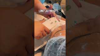 Real Patient 8D HIFU Treatment for Sagging Skin &amp; Jawline Tightening | Dr Himani Yadav | Gurgaon