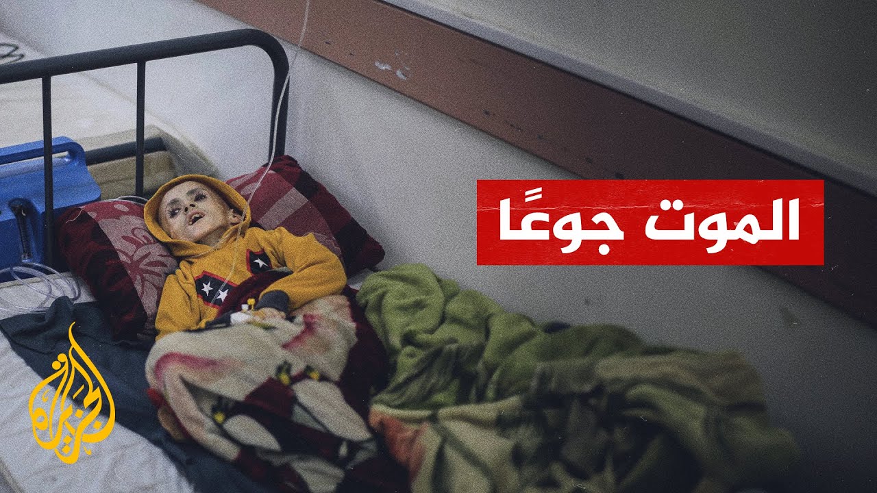 أسرة الطفل يزن الكفارنة: فقدنا ابننا بسبب الجوع وقلة الدواء حتى تحول لهيكل عظمي