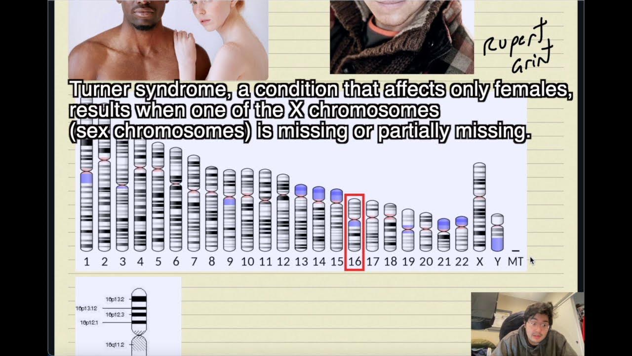 Blonde Hair and the Melanocortin 1 Receptor Gene - wide 6