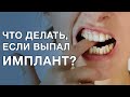 Что делать если выпал имплант зуба? Шатается имплант зуба.