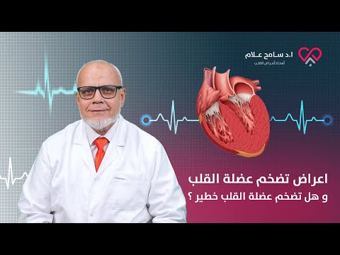 اعراض تضخم عضلة القلب و هل تضخم عضلة القلب خطير ؟ - دكتور سامح علام