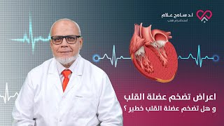 اعراض تضخم عضلة القلب و هل تضخم عضلة القلب خطير ؟ - دكتور سامح علام