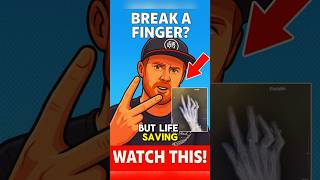 Broken Finger First Aid That Could Prevent Surgery