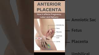 Anterior Placenta Position – How It Affects Pregnancy, Labor and Delivery