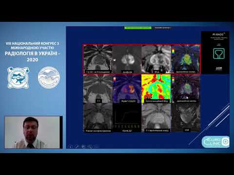 Мультипараметрична МРТ простати, майстер клас