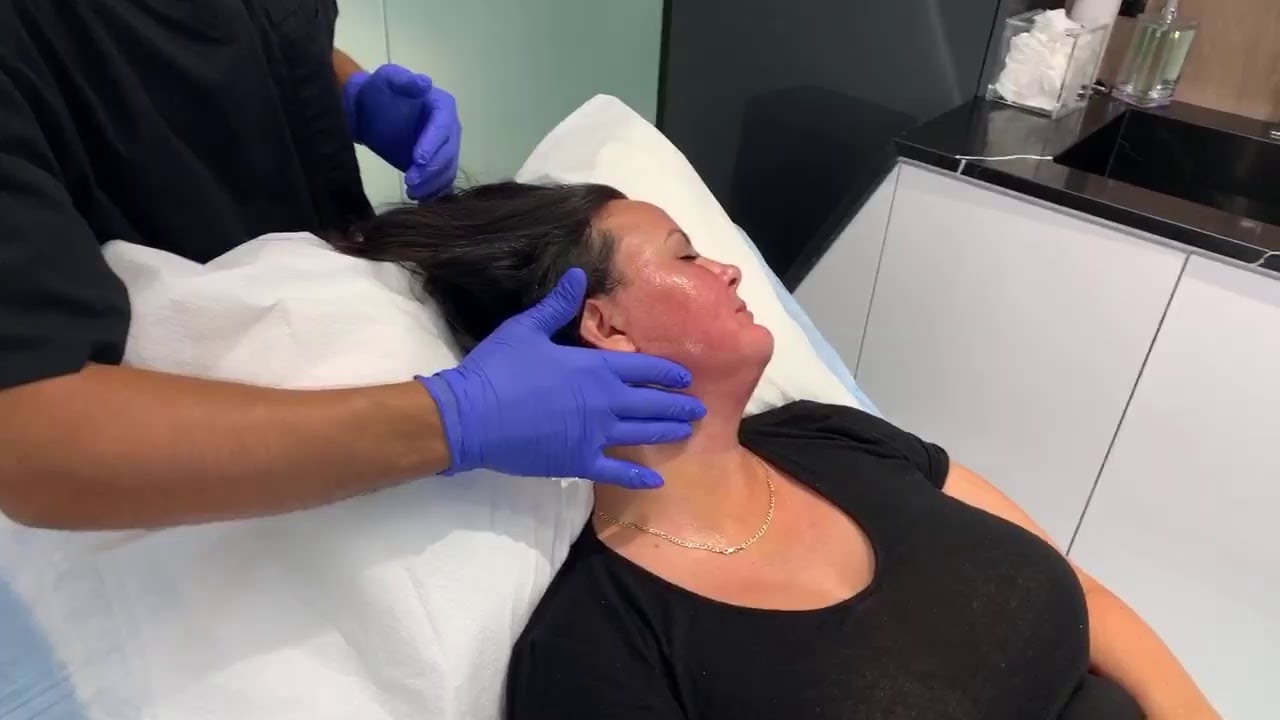 Lymphatic Massage To The Neck Post Renuvion Skin Tightening Dr. Jason Emer MD YouTube