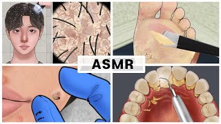 [ASMR]두피각질부터 치석까지 ! 속 시원해지는 케어 모음집 /Scalp keratin, foot hyperkeratosis, tartar removal, acne squeeze