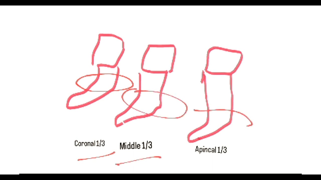 Dilaceration| Abnormalities of teeth