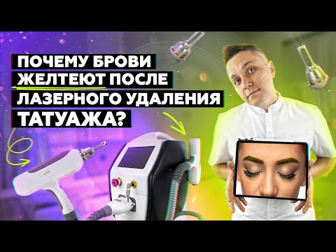 ПОЧЕМУ брови ЖЕЛТЕЮТ после лазерного удаления?