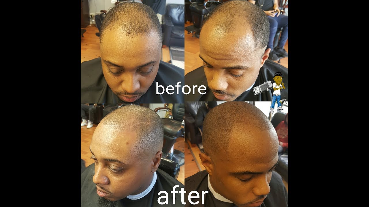 Dont Go Bald Is Your Barber Really Cutting Your Hair The Right