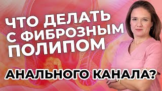 Что делать с фиброзным полипом анального канала?